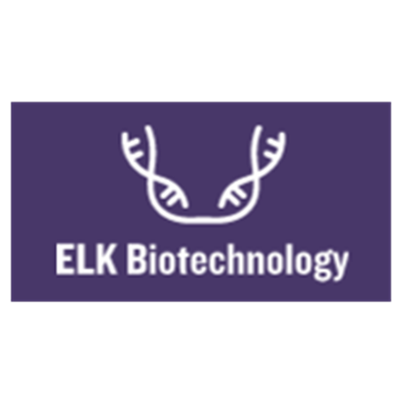 Human HE4(Epididymal protein 4) ELISA Kit