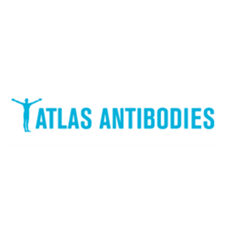 Anti-PVALB Antibody 100ul