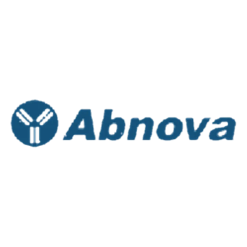 ATP6V0A1 (Human) Recombinant Protein (P01)